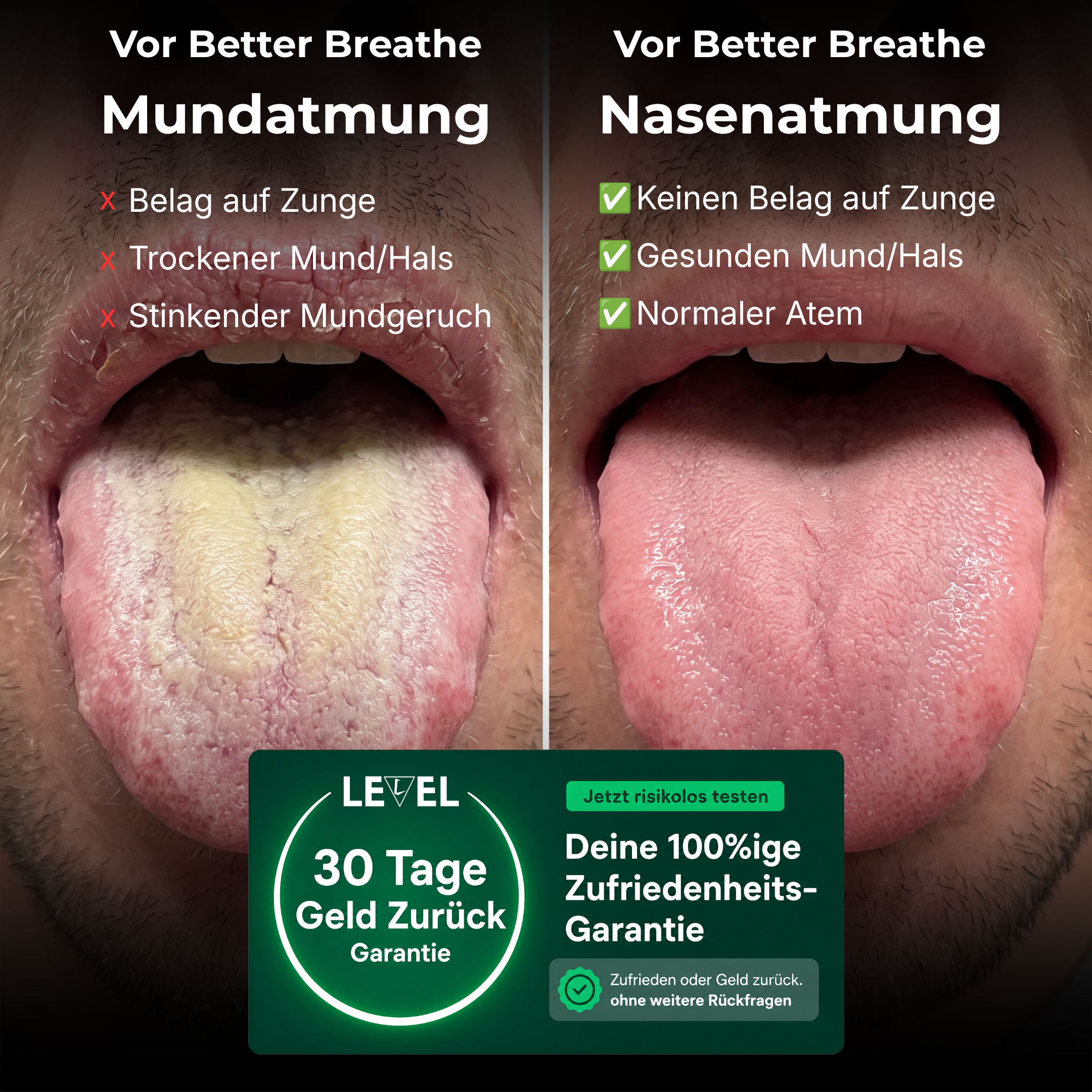 Better Breathe Nasenstrips mit SkinPro Klebeformel